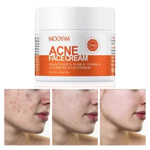 Acne Treatment for Face, Salicylic Acid Acne Cream Back Acne Treatment